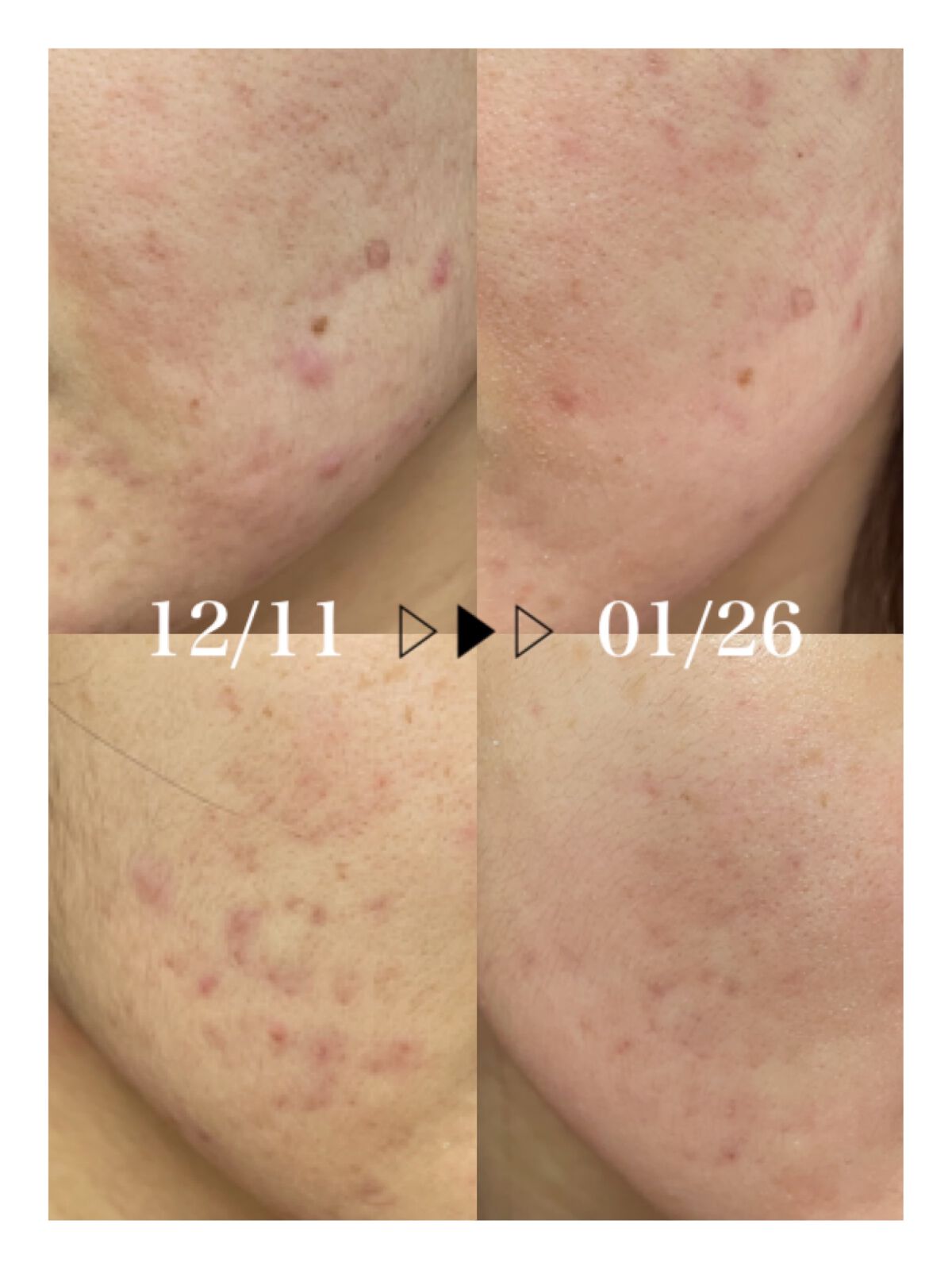 DHC マルチビタミン/DHC/美容サプリメントを使ったクチコミ（2枚目）