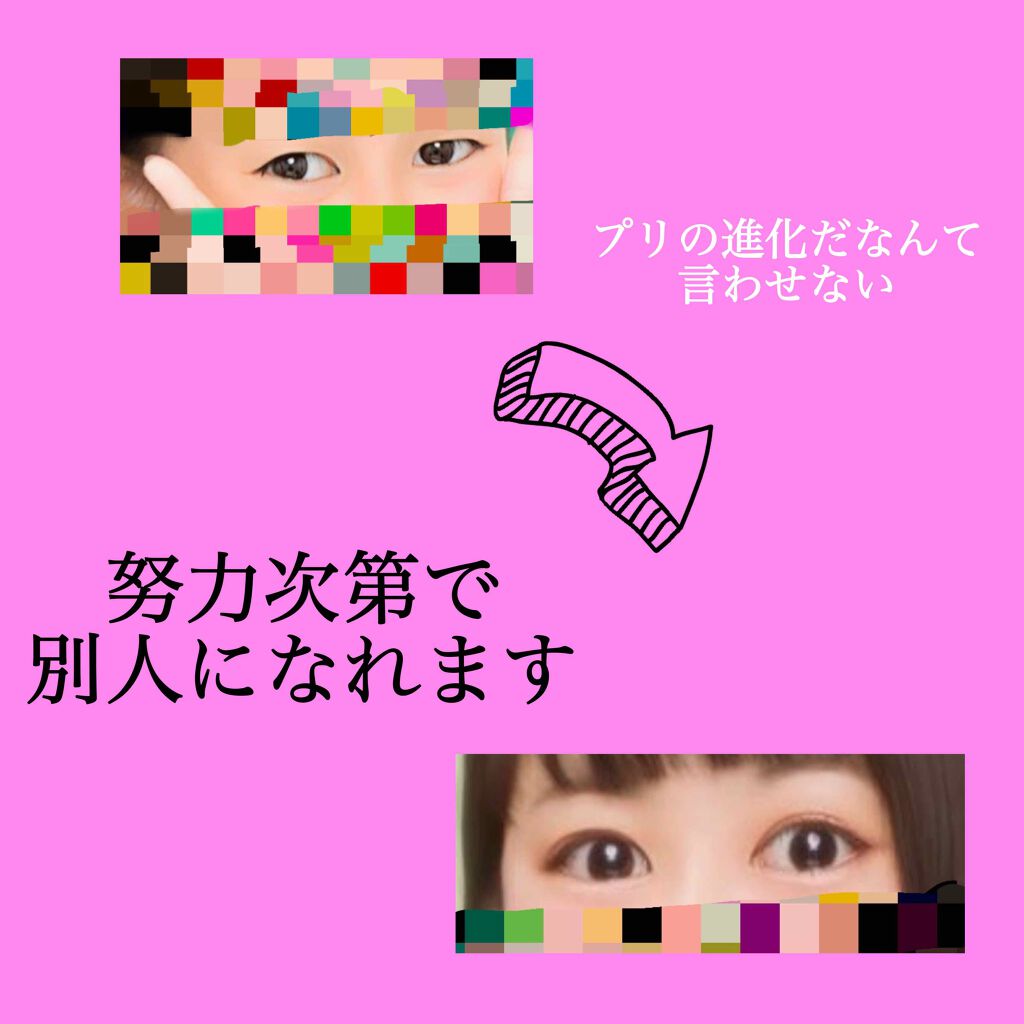 アイトーク/アイトーク/二重まぶた用アイテムを使ったクチコミ（1枚目）