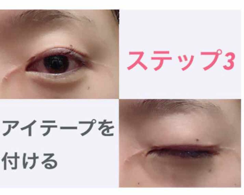 ワンダーアイリッドテープ リタッチボンド/D-UP/二重まぶた用アイテムを使ったクチコミ(3枚目)