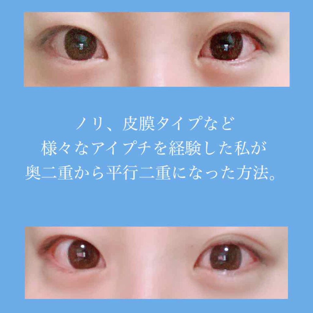 しなやかフィット/DAISO/二重まぶた用アイテムを使ったクチコミ（1枚目）