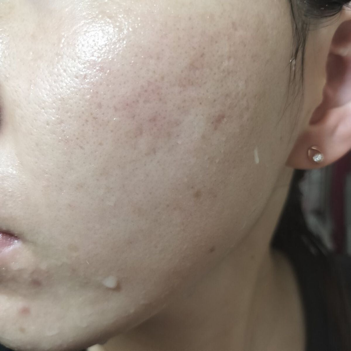 ハトムギ化粧水(ナチュリエ スキンコンディショナー R )/ナチュリエ/化粧水を使ったクチコミ(2枚目)