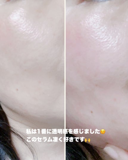 NIACIN 20% セラム/TIRTIR(ティルティル)/美容液を使ったクチコミ(5枚目)