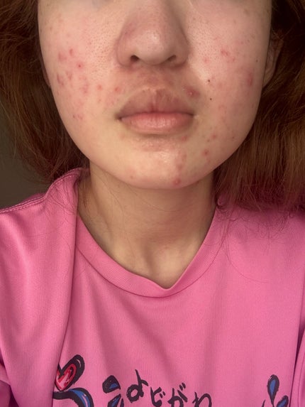 ミノン アミノモイスト ブライトアップベース UV/ミノン/化粧下地を使ったクチコミ(1枚目)