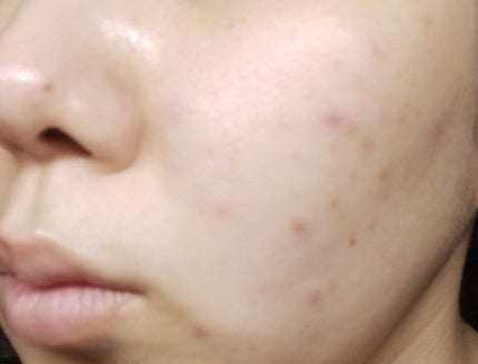 リサージ クリーミィソープa/リサージ/洗顔フォームを使ったクチコミ(2枚目)