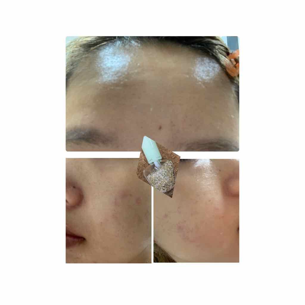 マイコンシーラー ワイド カバー/innisfree/リキッドコンシーラーを使ったクチコミ（2枚目）