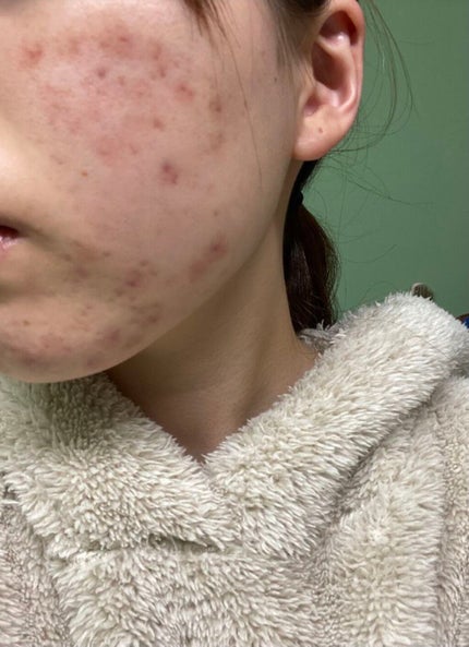 ロゼット洗顔パスタ ホワイトダイヤ/ロゼット/洗顔フォームを使ったクチコミ(3枚目)