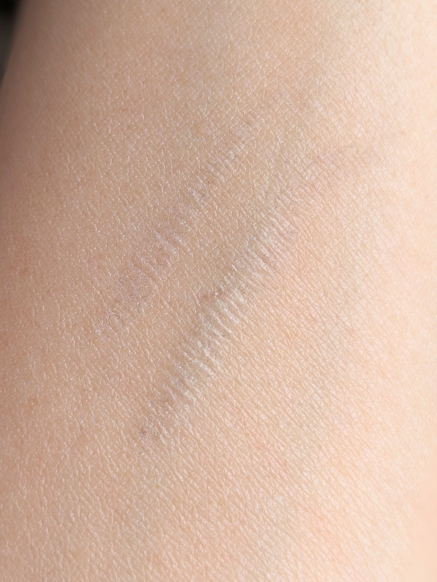 MENMEE フォールディンググルー/MENMEE /二重まぶた用アイテムを使ったクチコミ(8枚目)