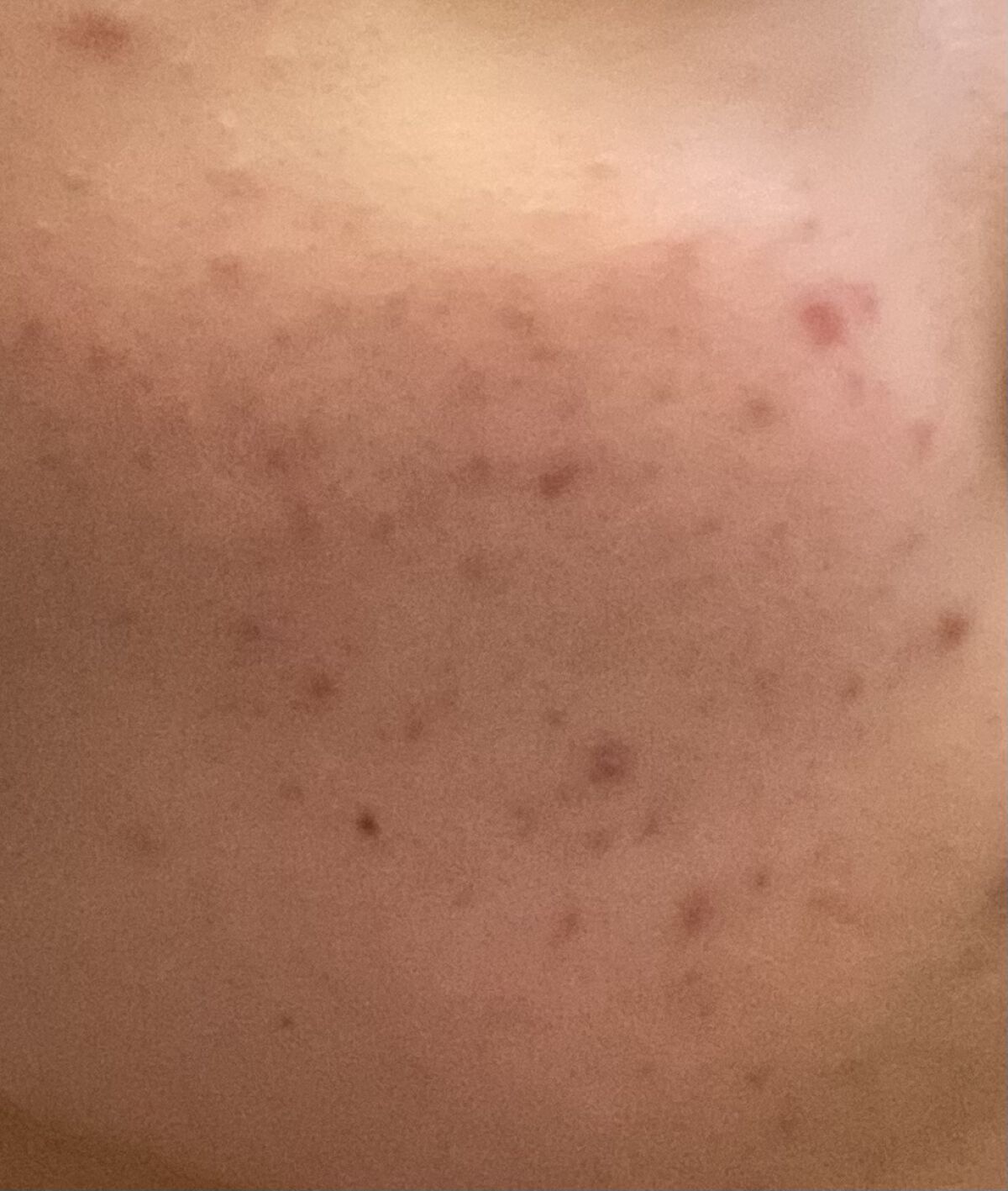 BCローション/DAISO/美容液を使ったクチコミ（2枚目）