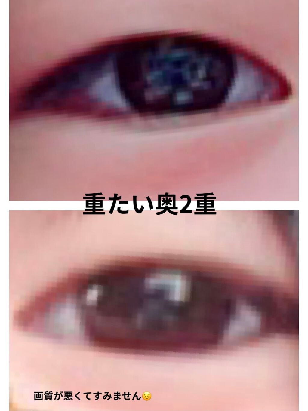 ゆらん︎︎ on LIPS 「中2の私がたった1週間で奥二重から二重にしたやり方を教えようと..」(1枚目)