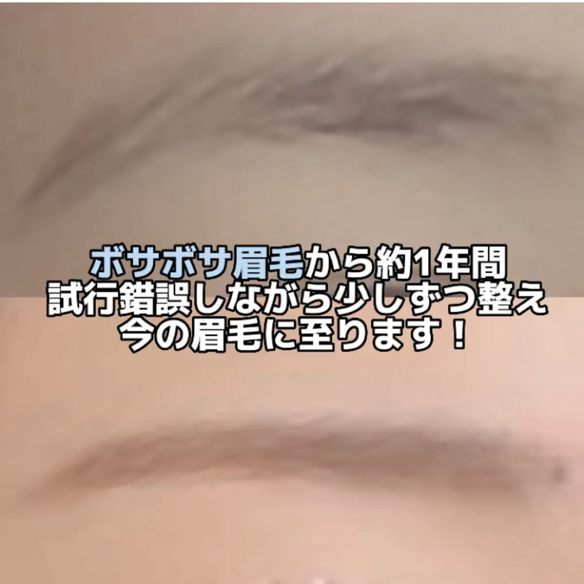 脱色クリーム 敏感肌用/エピラット/ムダ毛ケアを使ったクチコミ（2枚目）