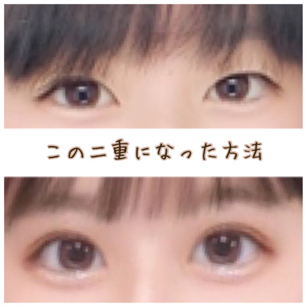 のびーるアイテープ(絆創膏タイプ、レギュラー)/DAISO/二重まぶた用アイテムを使ったクチコミ(1枚目)