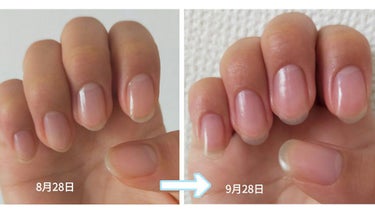 キューティクルネイルオイル ペンタイプ/No nail No life/ネイル用品を使ったクチコミ（3枚目）