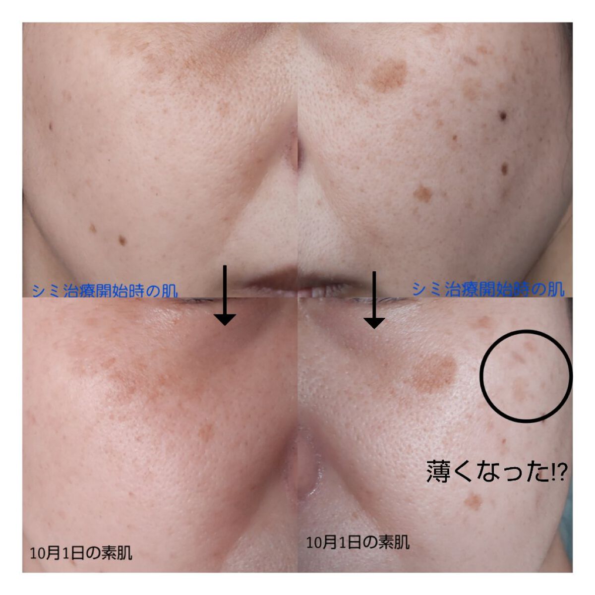 シナール配合錠(医薬品)	/シオノギ製薬/その他を使ったクチコミ（2枚目）