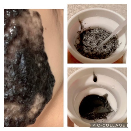 ニードル炭酸パック/NNE/洗い流すパック・マスクを使ったクチコミ(6枚目)