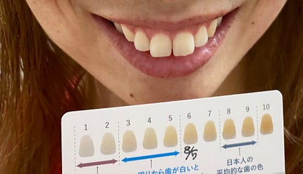 ルルホワイト/ルルシア/その他オーラルケアを使ったクチコミ(5枚目)