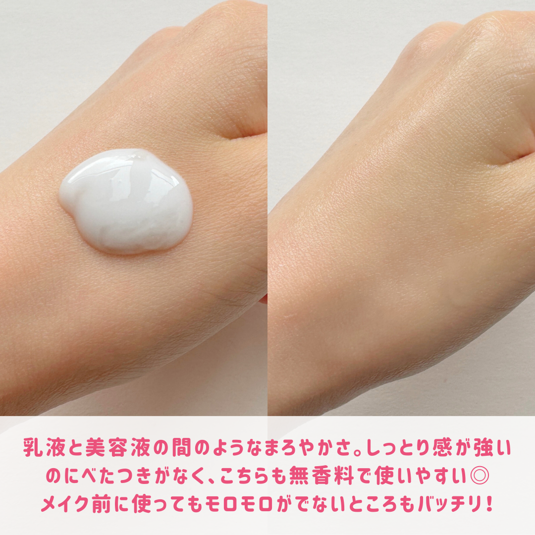 モイスチュア ローション/カルテHD/化粧水を使ったクチコミ(5枚目)