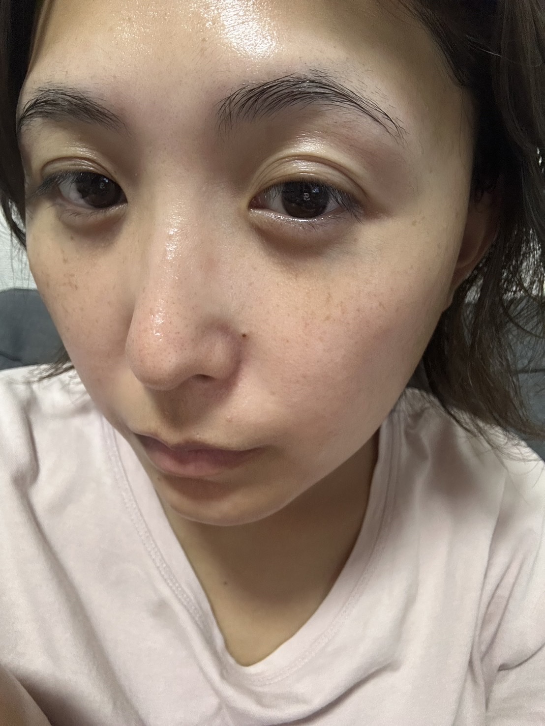 ファイン100/imini/美容液を使ったクチコミ（3枚目）