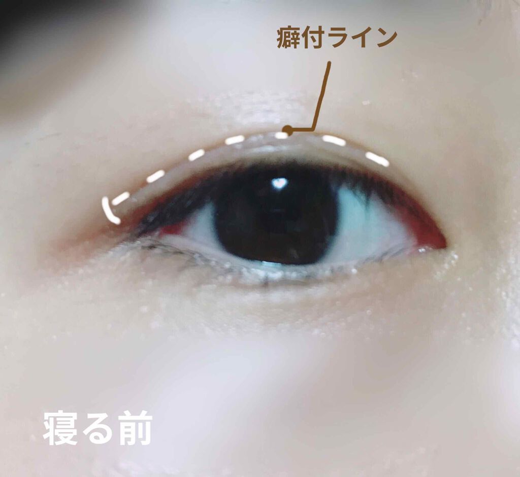 ナイトアイボーテ/StreeTrend/二重まぶた用アイテムを使ったクチコミ(3枚目)