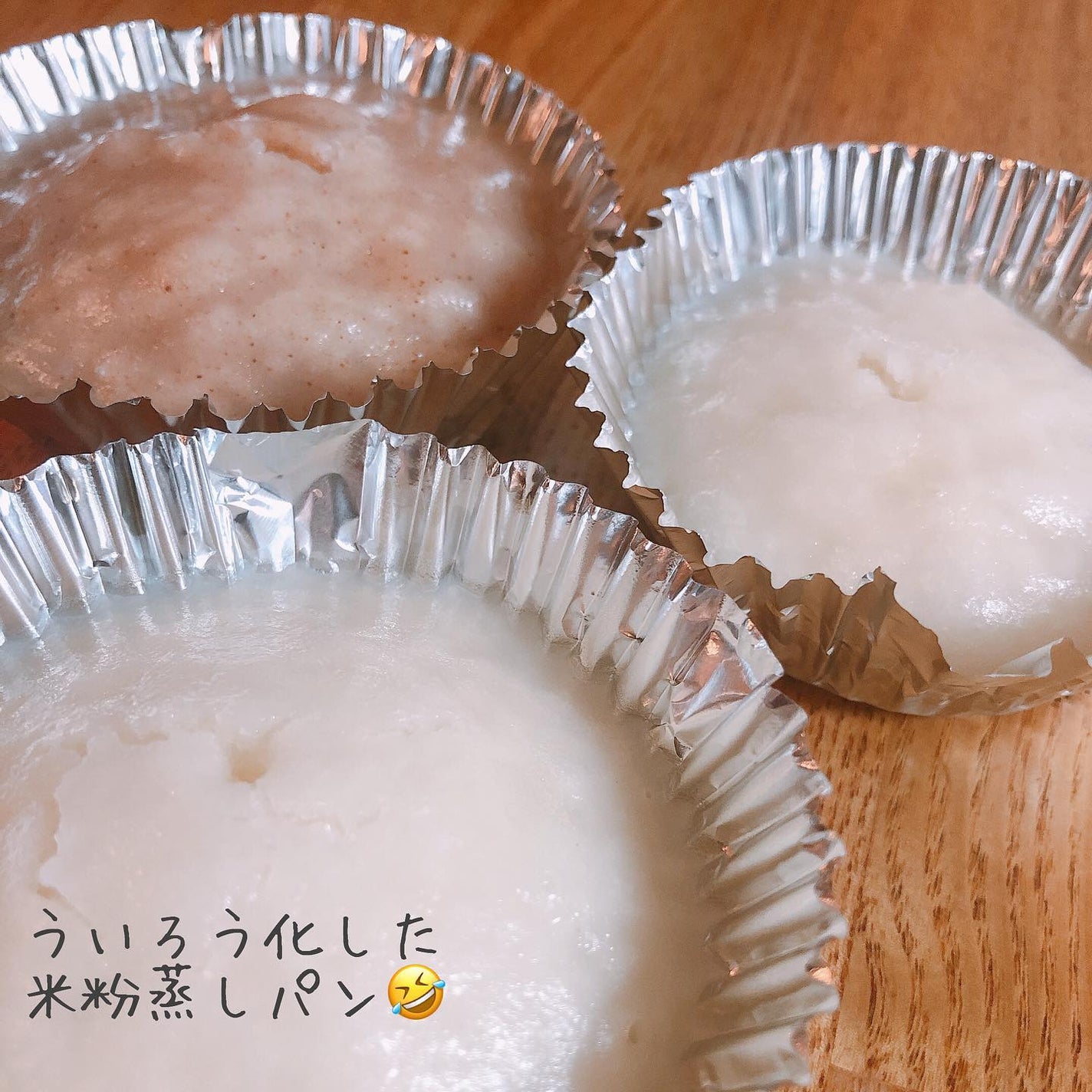 おゆみ|ニキビ・ニキビ跡ケア on LIPS 「外出自粛でタイミングを見失った生え際…🤣🤣🤣4月ももう..」(8枚目)