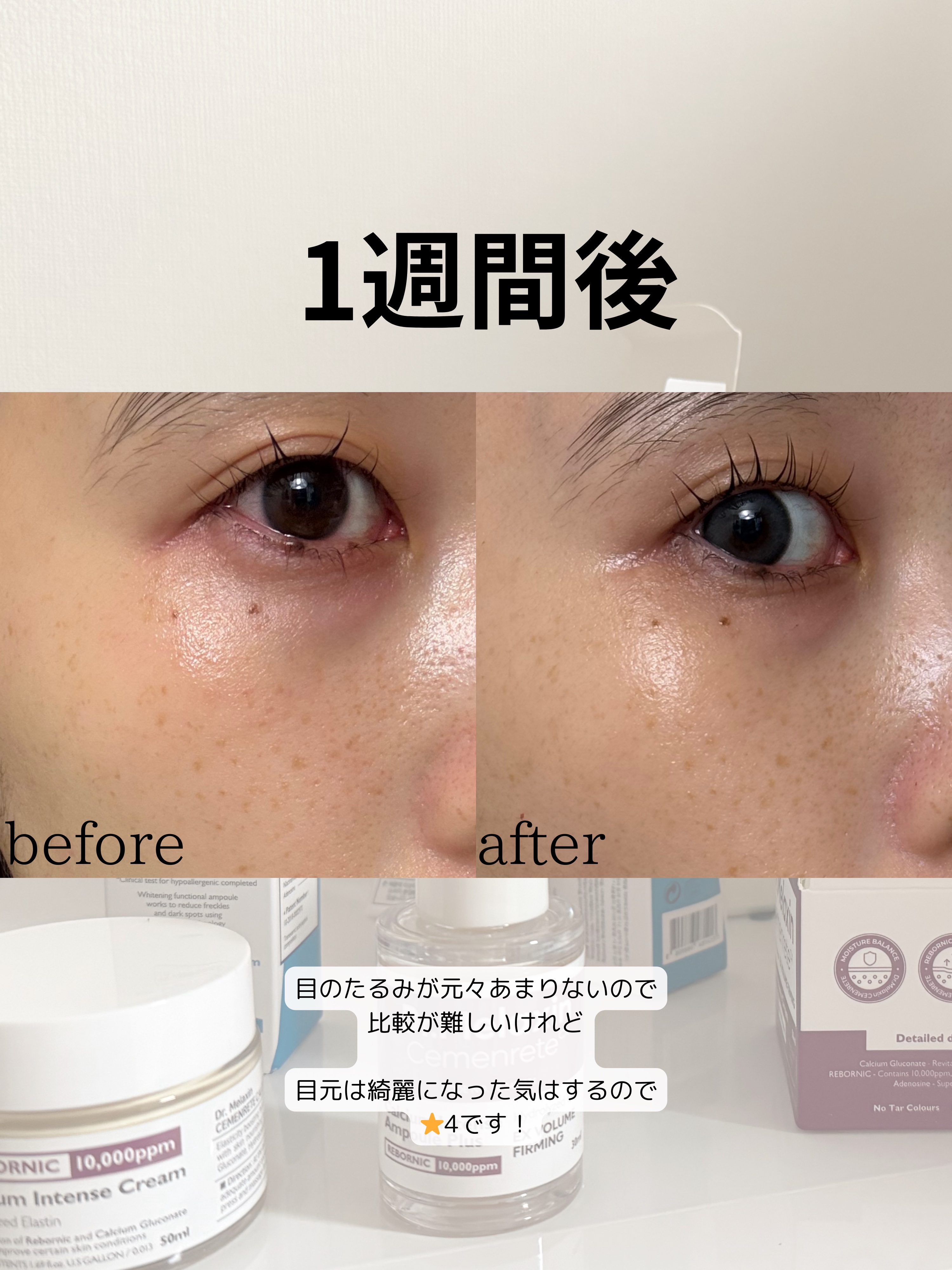 Cemenrete Calcium Intense Cream/Dr.Melaxin/フェイスクリームを使ったクチコミ（2枚目）