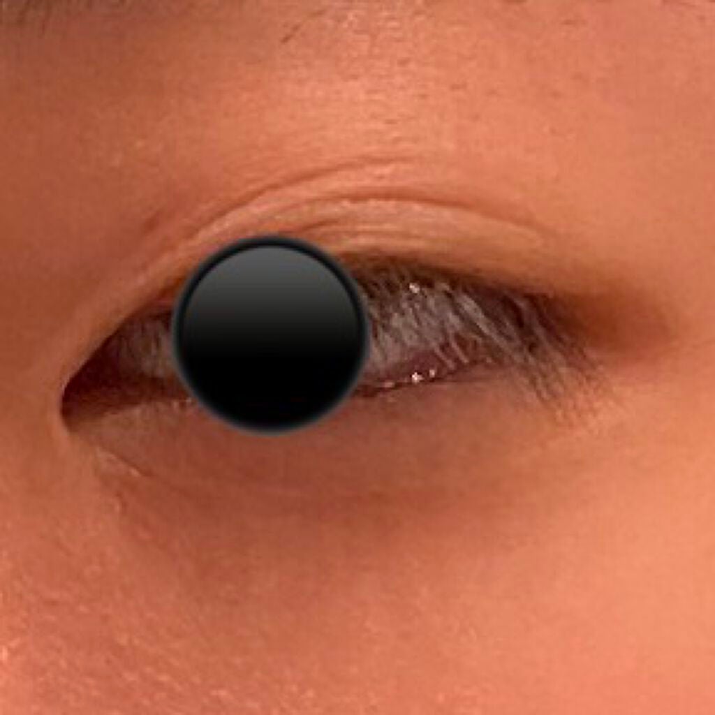 オリシキ アイリッドスキンフィルム /D-UP/二重まぶた用アイテムを使ったクチコミ(5枚目)