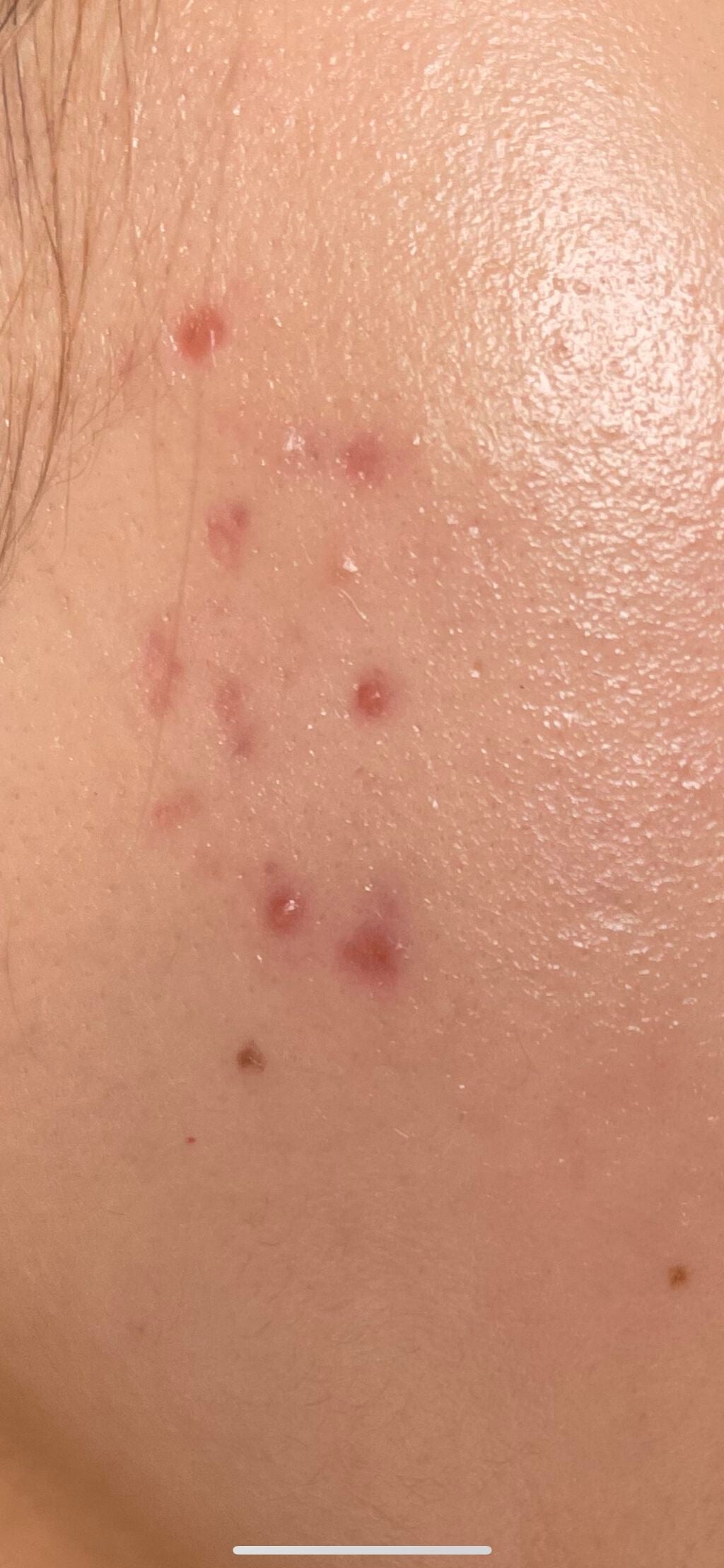 Amm on LIPS 「初めまして。ずっとこちらのアプリを見る専として愛用していました..」(2枚目)