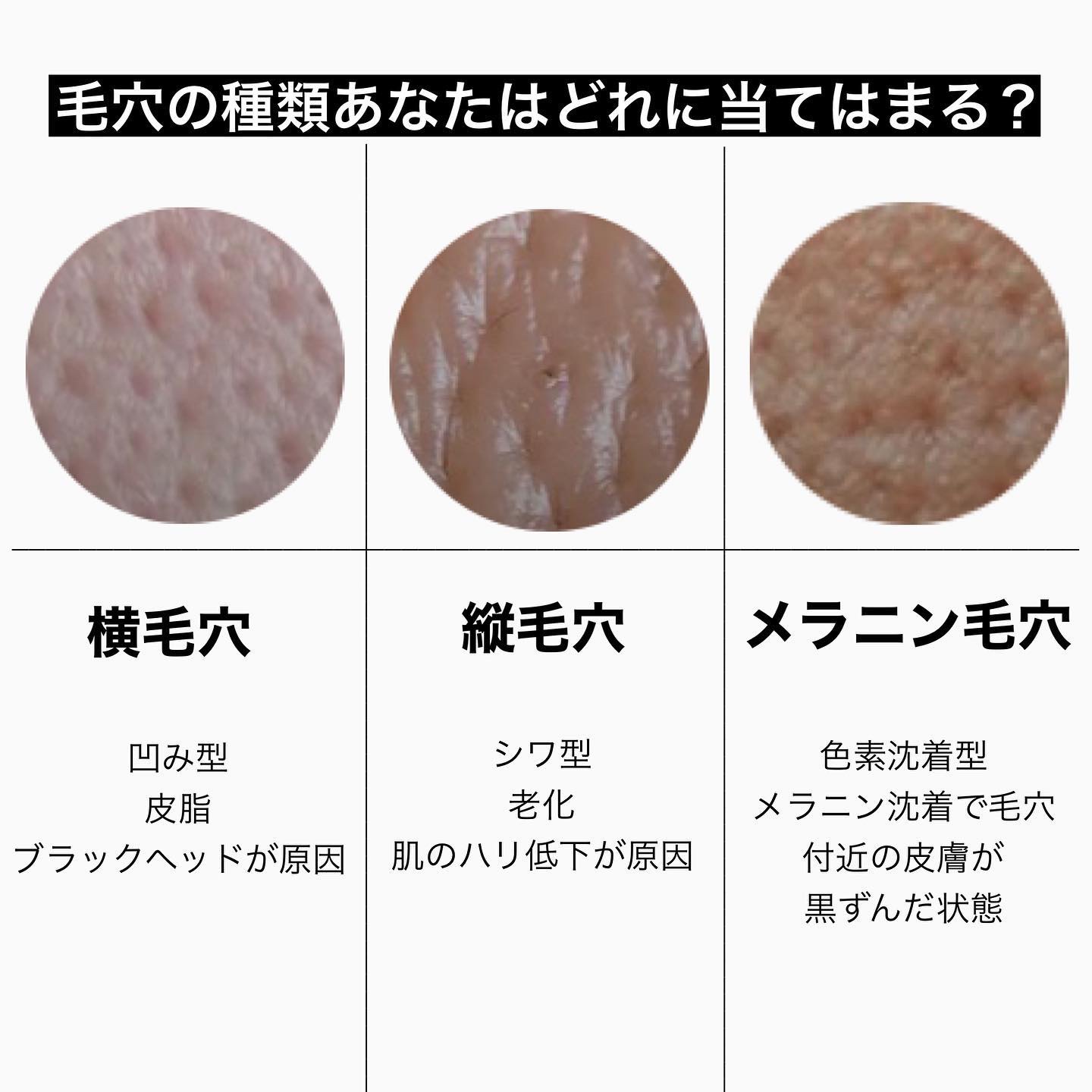 ゼロ毛穴パッド 2.0/MEDICUBE/トナーパッドを使ったクチコミ（2枚目）