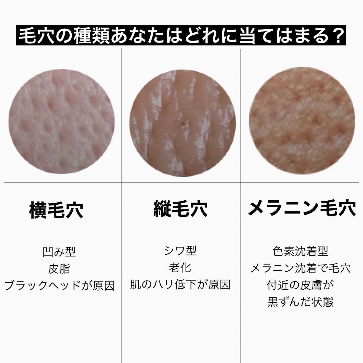 ゼロ毛穴パッド 2.0/MEDICUBE/トナーパッドを使ったクチコミ(2枚目)