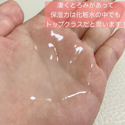 モイスチュア ローション/カルテHD/化粧水を使ったクチコミ(2枚目)