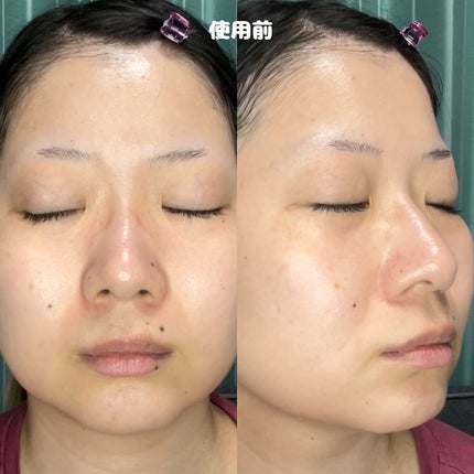 クリアニック ホワイトマスク/Dr.Twenty Project/シートマスク・パックを使ったクチコミ(8枚目)