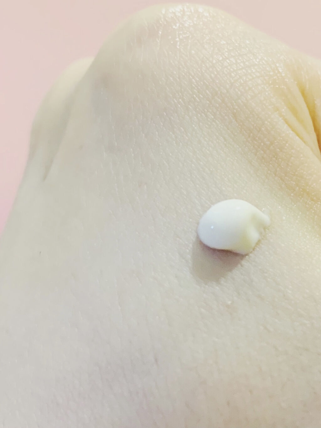 fサインディフェンス リペアランススポッツアクネ/AYURA/美容液を使ったクチコミ（2枚目）