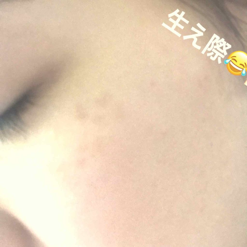 マジックコンシーラー/カリプソ/リキッドコンシーラーを使ったクチコミ（2枚目）