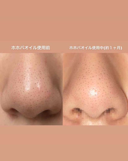 ハトムギ化粧水(ナチュリエ スキンコンディショナー R )/ナチュリエ/化粧水を使ったクチコミ(1枚目)