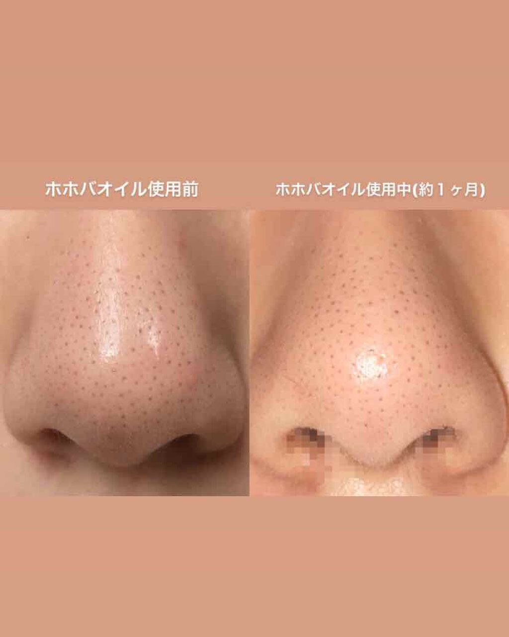 スキンケア方法》ハトムギ化粧水(ナチュリエ スキン スキンケア方法》ハトムギ化粧水(ナチュリエ スキン