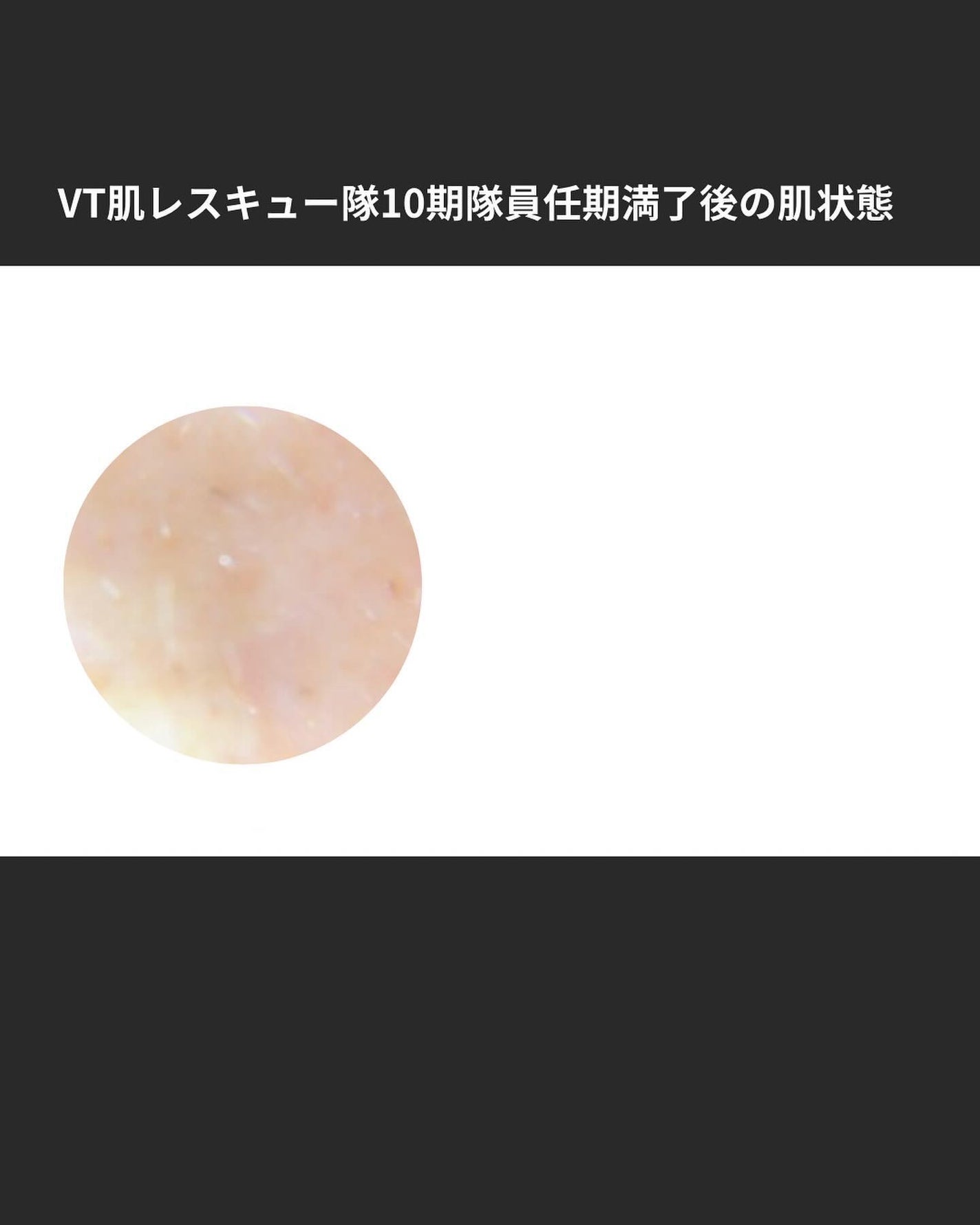 リードルショット300/VT/美容液を使ったクチコミ(4枚目)