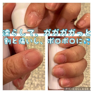 Electric Nail Care Set/セリア/ネイル用品を使ったクチコミ（3枚目）