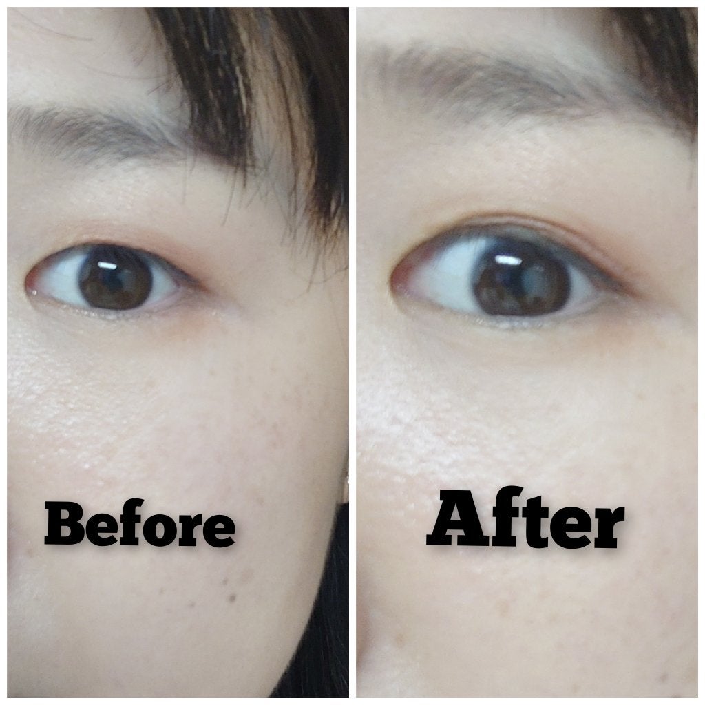 メザイク イージークリア 接着クリアタイプ/メザイク/二重まぶた用アイテムを使ったクチコミ(8枚目)