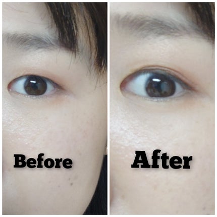 メザイク イージークリア 接着クリアタイプ/メザイク/二重まぶた用アイテムを使ったクチコミ(8枚目)