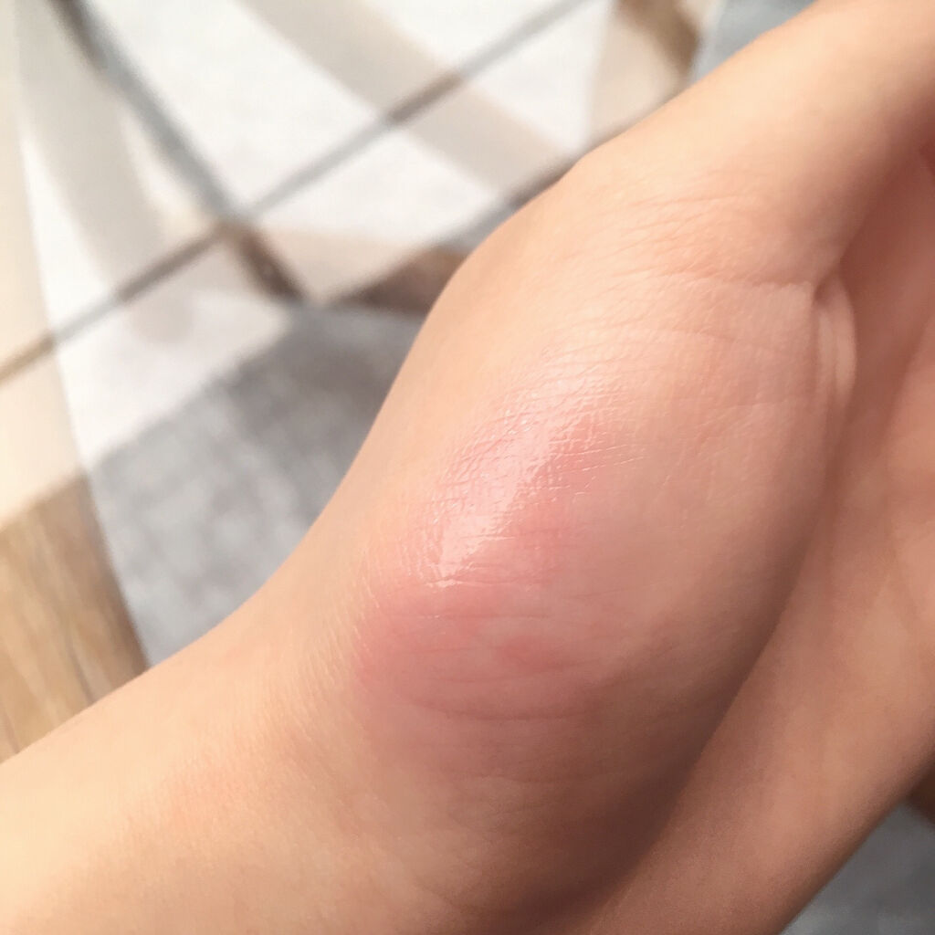 メルティカラー ティントリップ/フォーチュン/リップティントを使ったクチコミ（3枚目）