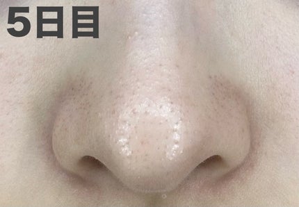 パーフェクトワンフォーカス スムースクレンジングバーム ディープブラック/PERFECT ONE FOCUS/クレンジングバームを使ったクチコミ(2枚目)