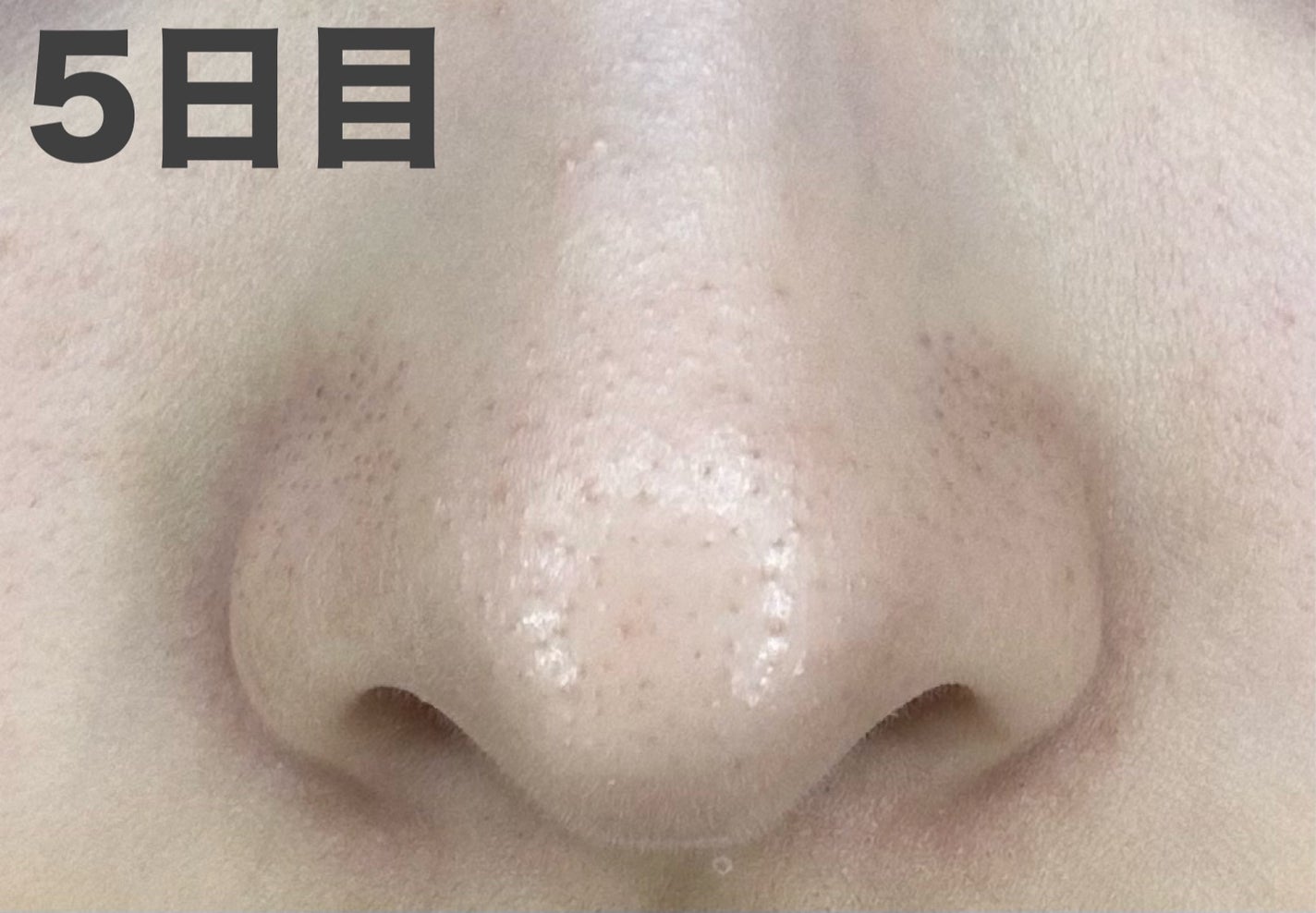 パーフェクトワンフォーカス スムースクレンジングバーム ディープブラック/PERFECT ONE FOCUS/クレンジングバームを使ったクチコミ(9枚目)