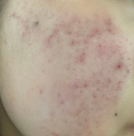 を使ったクチコミ(2枚目)