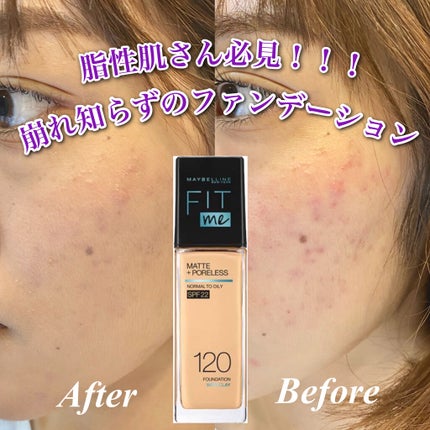 フィットミー リキッドファンデーション R/MAYBELLINE NEW YORK/リキッドファンデーションを使ったクチコミ(1枚目)