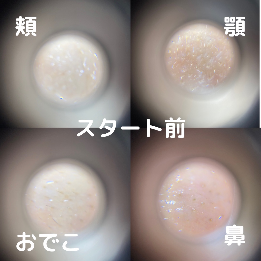 CICA クリーム/VT/フェイスクリームを使ったクチコミ（3枚目）