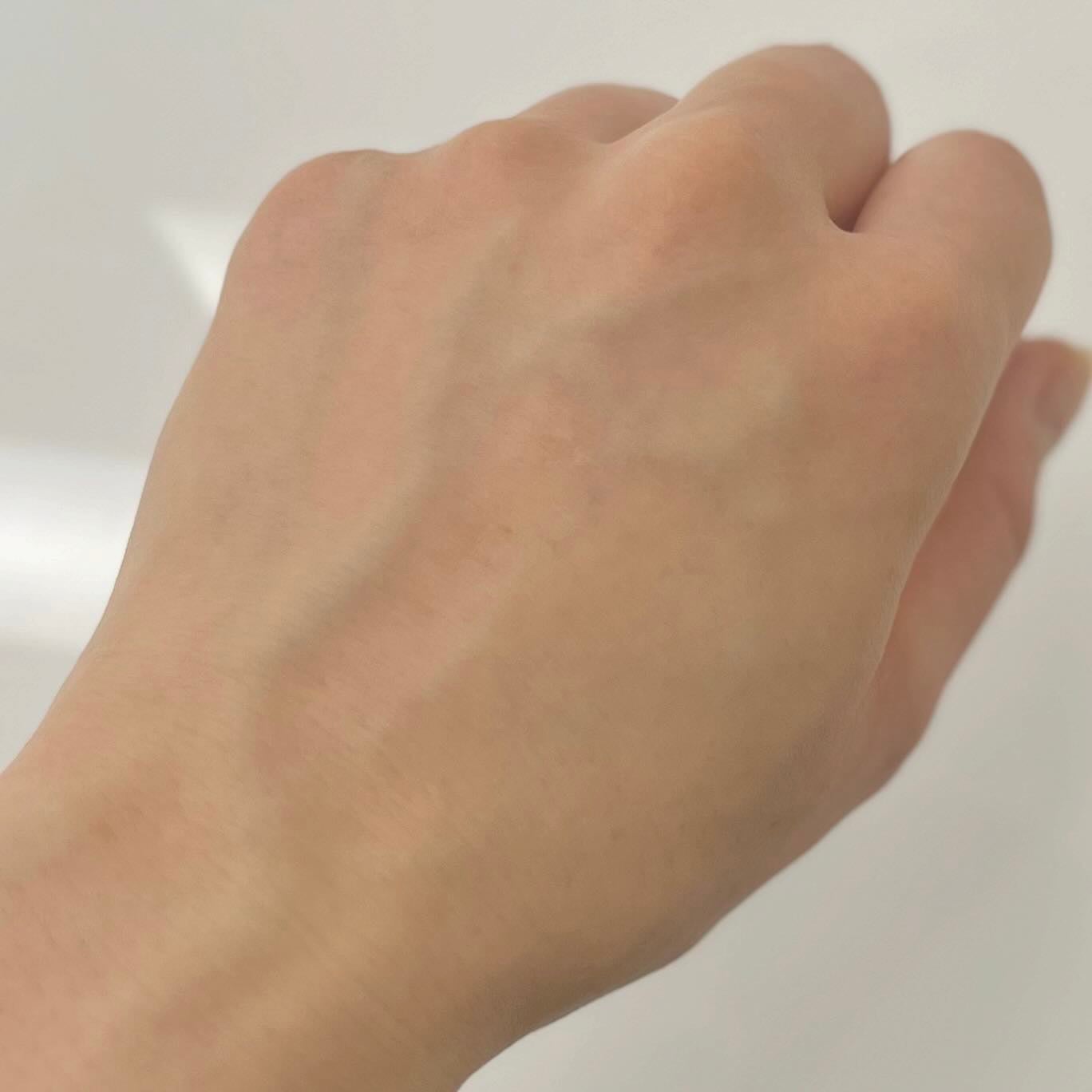 ファイン100/imini/美容液を使ったクチコミ(3枚目)