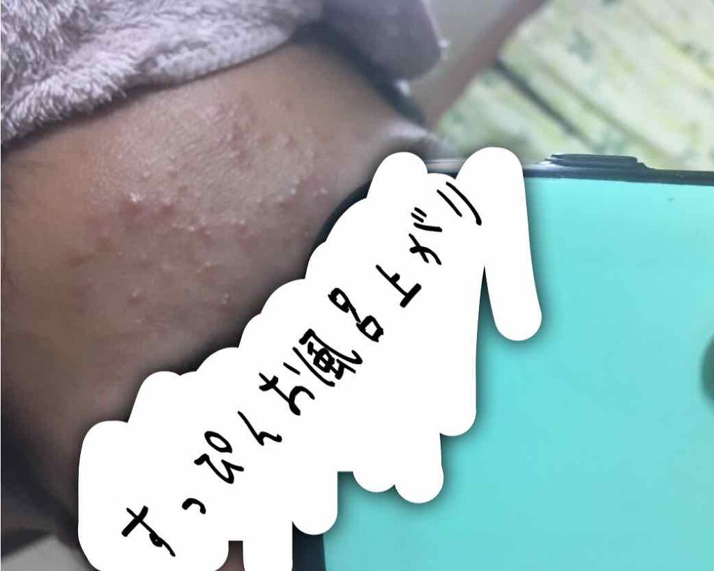 桜舞 on LIPS 「今だから分かる急にできたニキビの原因ときっかけ【乾燥】私の場合..」(3枚目)