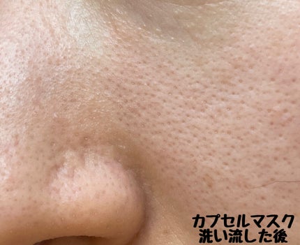 CICA カプセルマスク/VT/洗い流すパック・マスクを使ったクチコミ(5枚目)