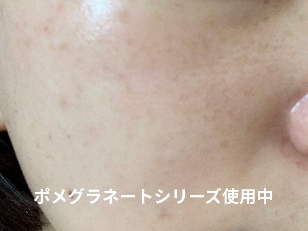 ポメグラネート バイタル エマルジョン/innisfree/乳液を使ったクチコミ(2枚目)