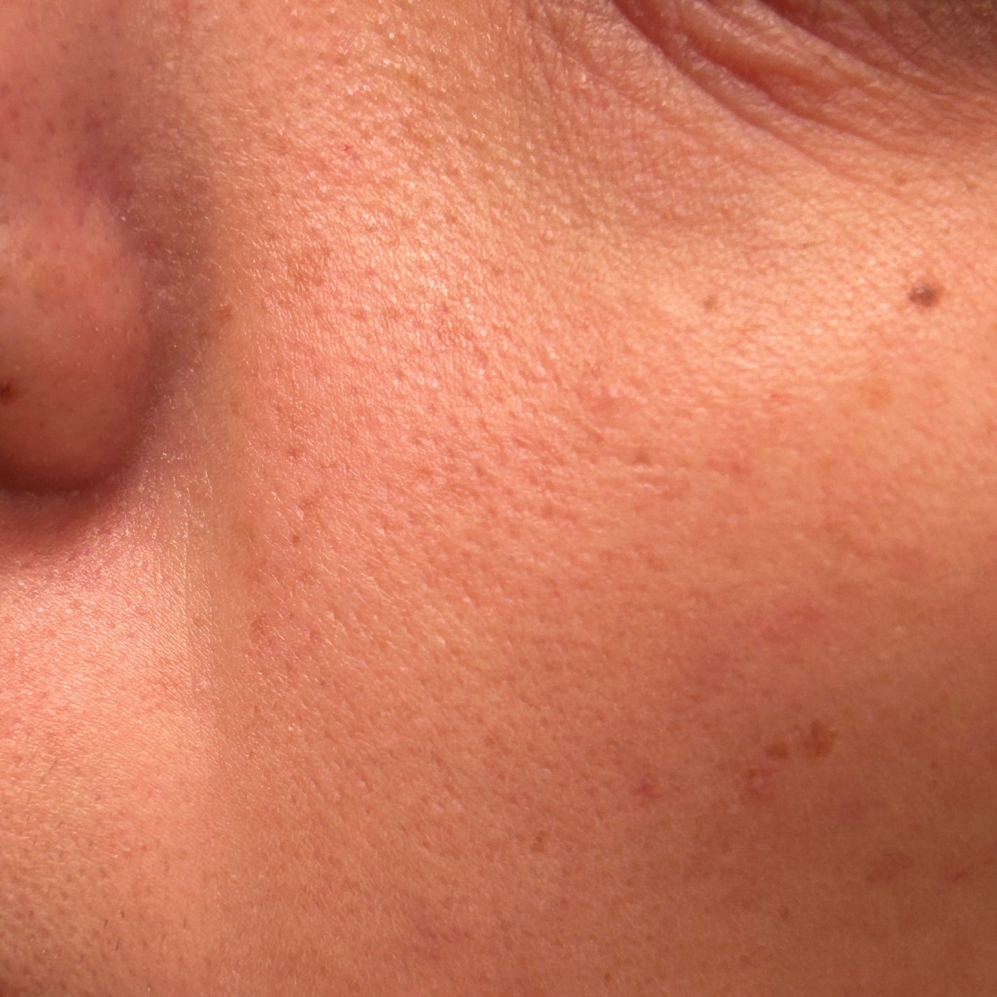 すっぴんパウダー/クラブ/プレストパウダーを使ったクチコミ(8枚目)