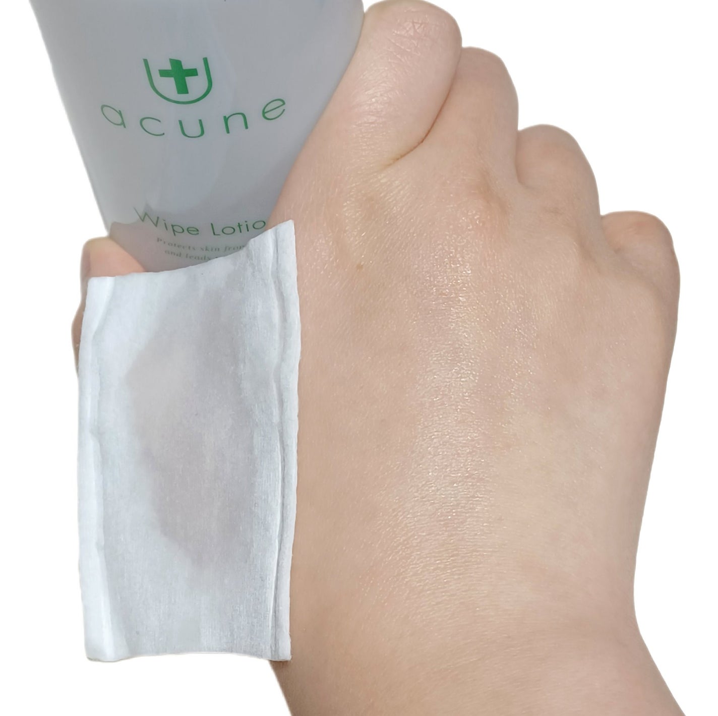 アキュネ 薬用ふきとりローションU/アキュネ/拭き取り化粧水を使ったクチコミ(4枚目)